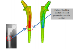 Fatigue evaluation